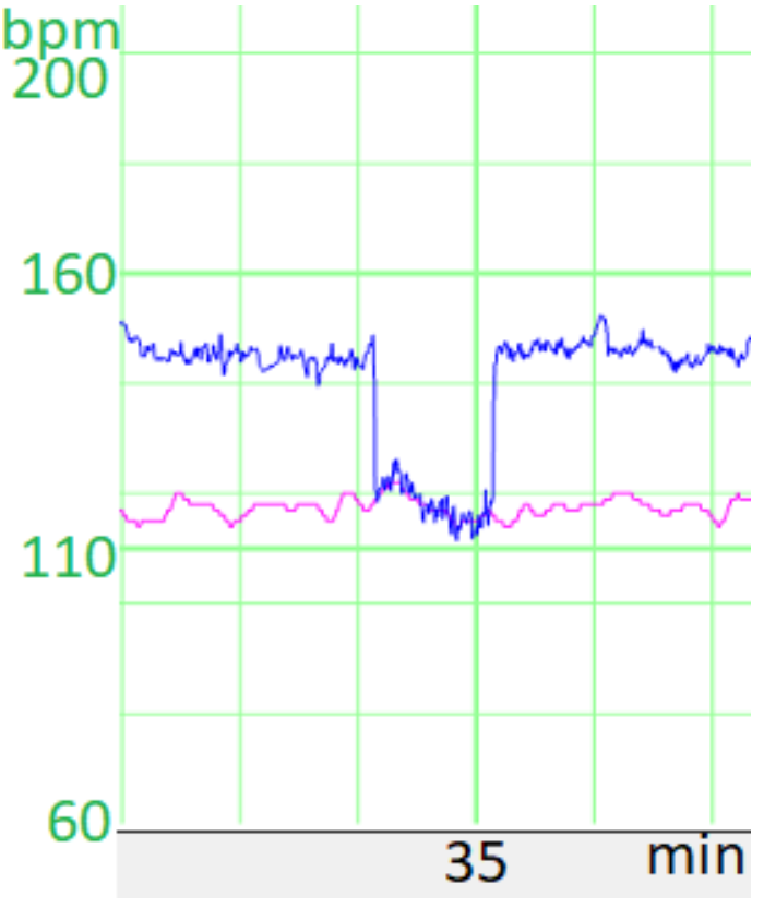 example of device interpolation between false and true signals