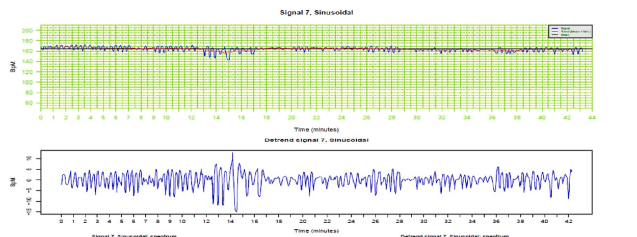 True sinusoidal pattern — raw FHR trace and its detrended signal (Savirón-Cornudella et al. 2024, Fig. 1)